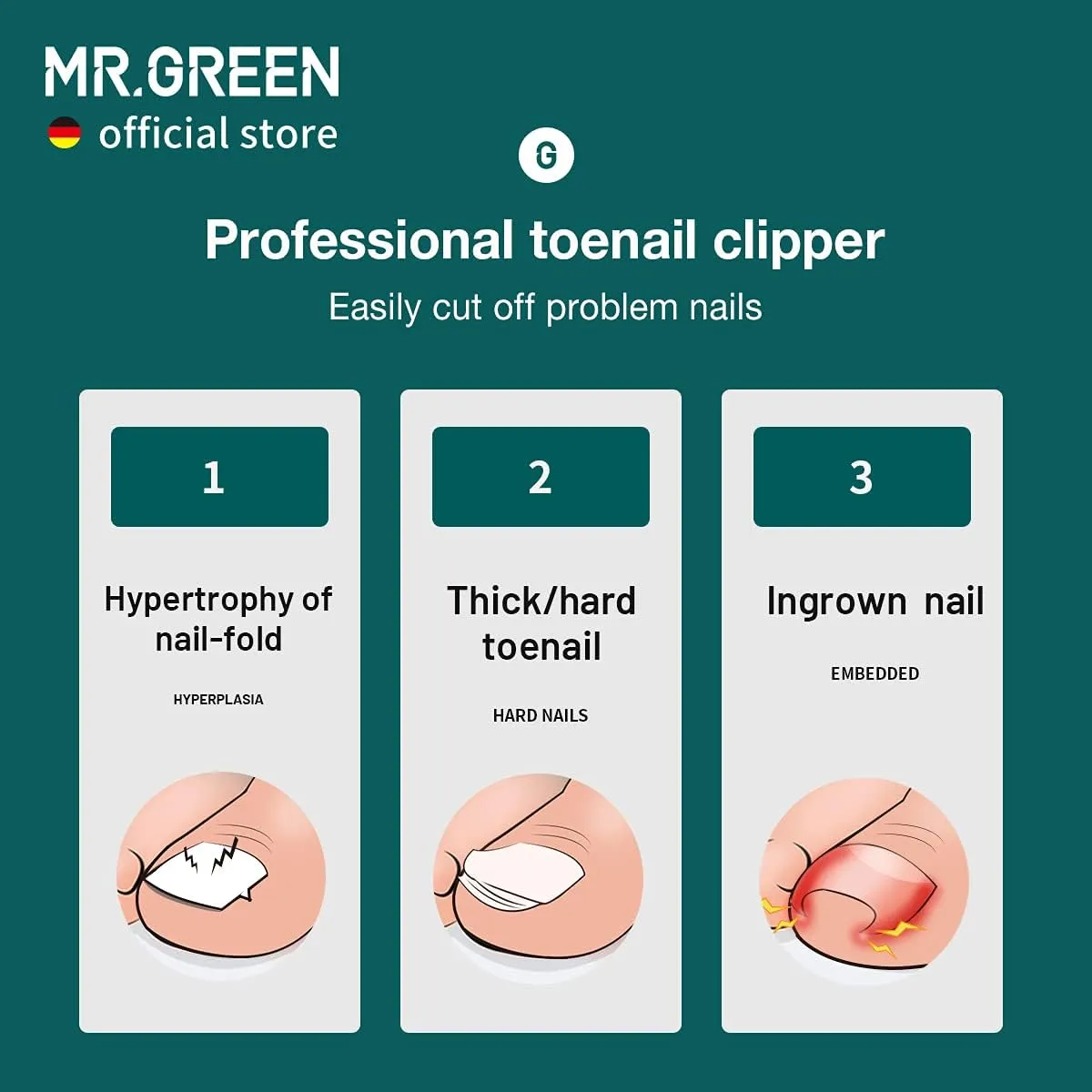 MR.GREEN Nail Clippers Toenail Cutters Anti-Splash Professional Ingrown Thick Hard Nail Scissors Pedicure Tools Manicure Sets (Orange Handle Nail Remover)